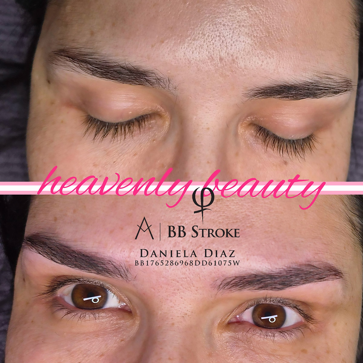 BB Stroke – weiteres Vorher/Nachher Ergebnis
